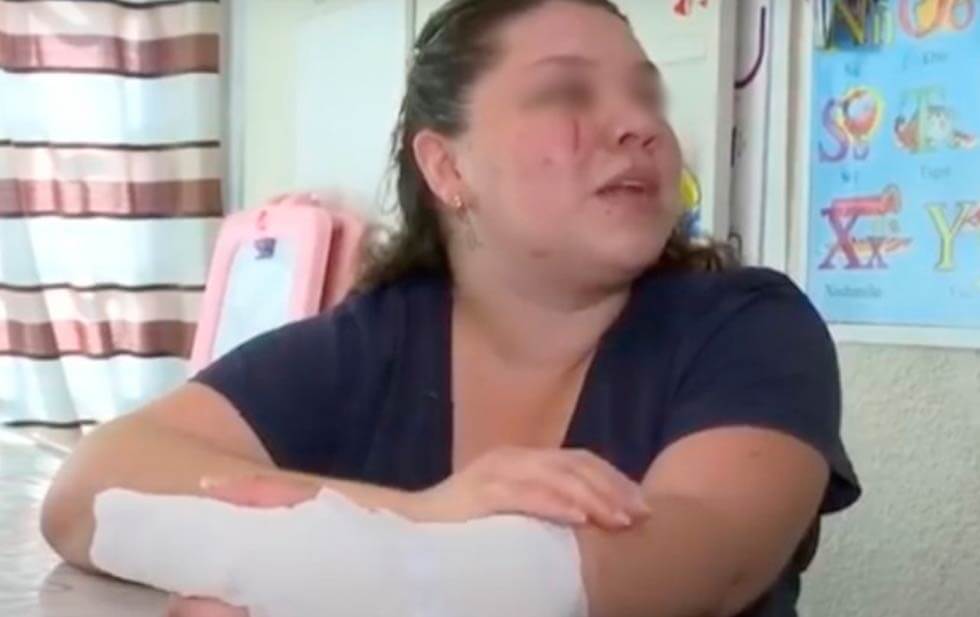 Francia López, enfermera de la Unidad de Gineco Pediatría del IMSS, fue golpeada brutalmente por un hombre y una mujer en la colonia Lindavista