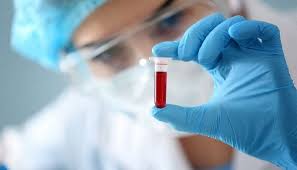 Se demuestra que una prueba de sangre detecta varios tipos de cáncer