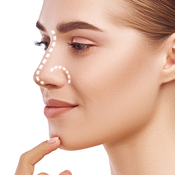 Rinoplastia: una cirugía de salud y belleza
