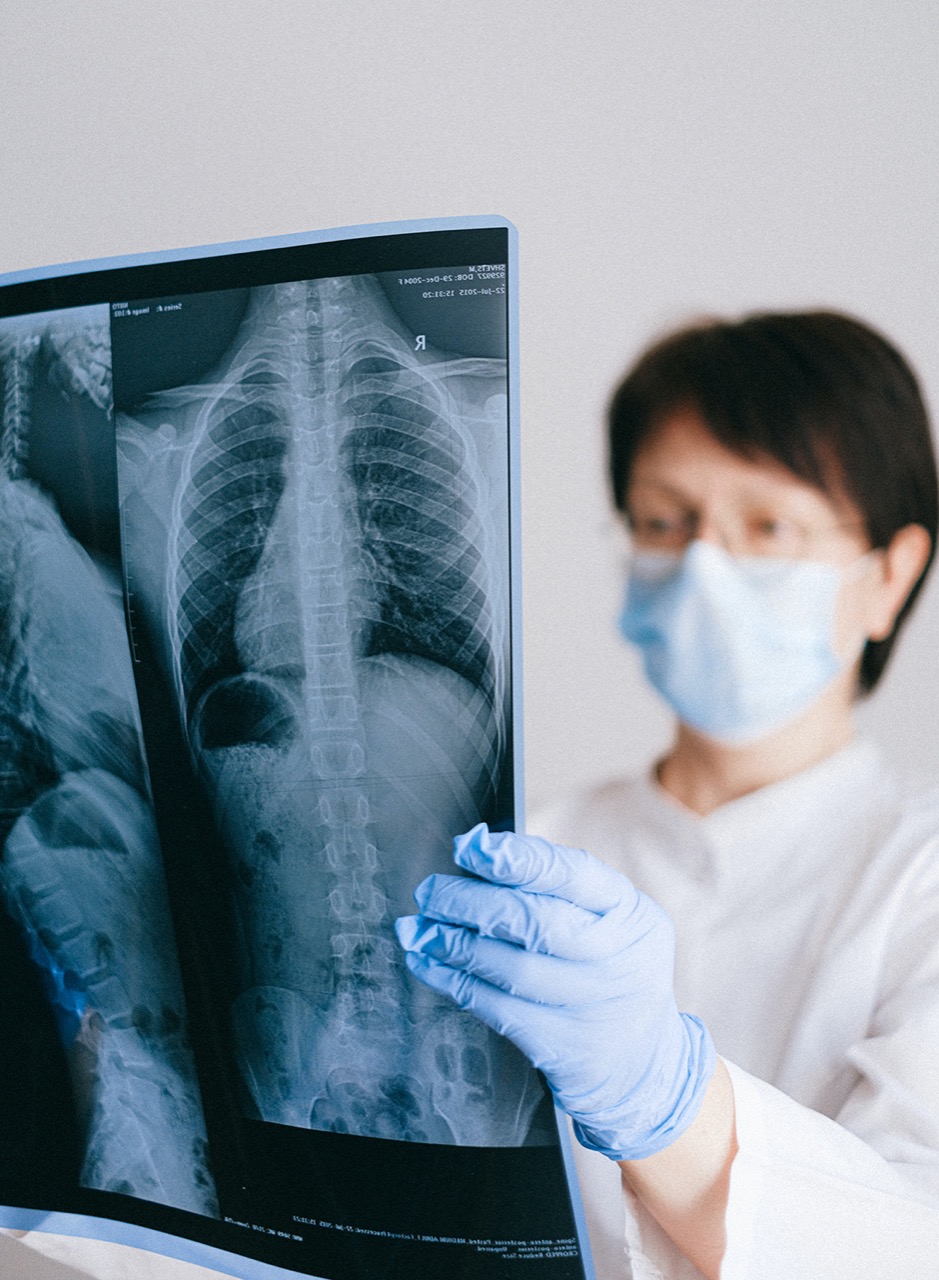 Issste refuerza acciones para prevenir y erradicar la tuberculosis