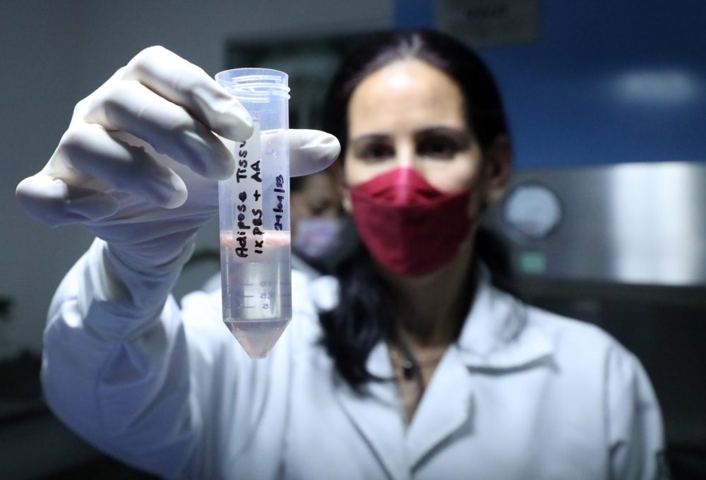 IMSS trabaja en células madre para reparar páncreas en pacientes diabéticos
