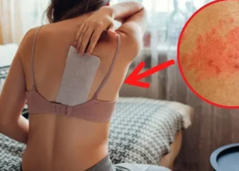 Herpes zóster: ¿Cuánto tiempo duran los síntomas y cómo tratar la «culebrilla»?