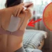 Herpes zóster: ¿Cuánto tiempo duran los síntomas y cómo tratar la «culebrilla»?