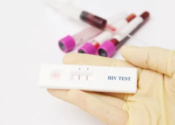 ¿Qué es la prueba rápida de VIH? La clave que puede cambiar tu diagnóstico, según especialistas