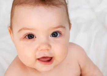 Ojo rojo en bebés: Podría tratarse de conjuntivitis viral o bacteriana, especialistas